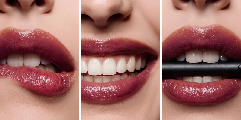 El regreso de las sonrisas naturales