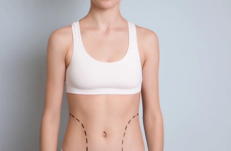 Young woman with marks on belly for cosmetic surgery operation against color background - Olga Yastremska, New Africa, Africa Studio