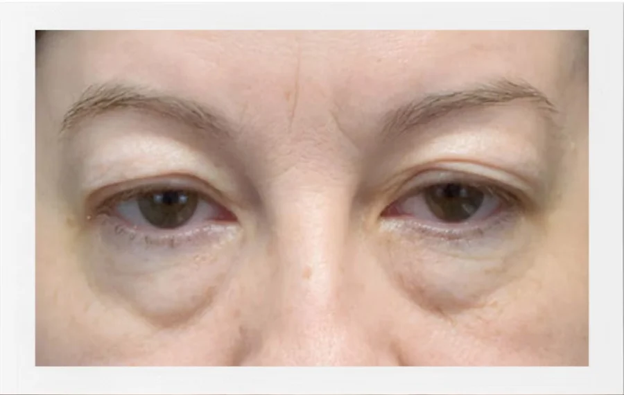 contorno de ojos - 1