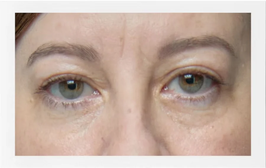 contorno de ojos - 1